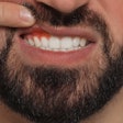 Inflamed Gums Man