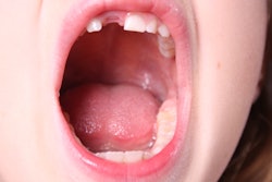 Kid Open Mouth