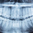 Panoramic Xray