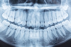 Panoramic Xray
