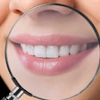 Teeth Magnifying Glass