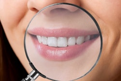 Teeth Magnifying Glass