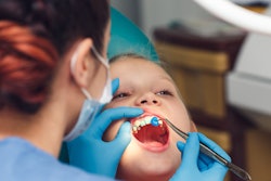 Child Fluoride Application