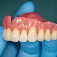 Denture Upper