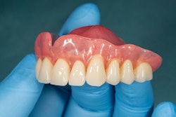 Denture Upper