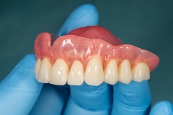 Denture Upper