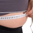 Obesity