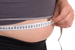 Obesity