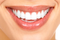 Smile3
