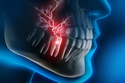 Tooth Pain