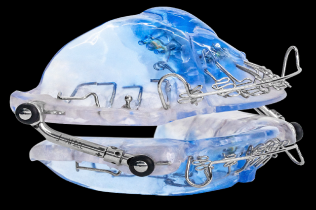 The Vivos OSA device. Image courtesy of Vivos Therapeutics.