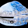 The Vivos OSA device. Image courtesy of Vivos Therapeutics.
