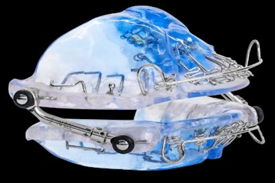 The Vivos OSA device. Image courtesy of Vivos Therapeutics.