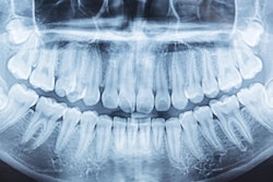 Panoramic Xray