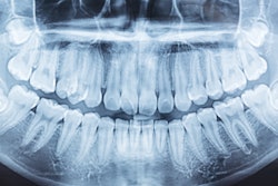 Panoramic Xray