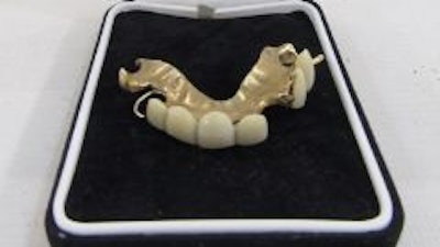 Partial upper gold-mounted denture designed for Sir Winston Churchill. Image courtesy of the Cotswold Auction Company.