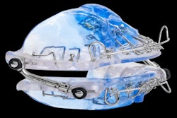 The Vivos OSA device. Image courtesy of Vivos Therapeutics.