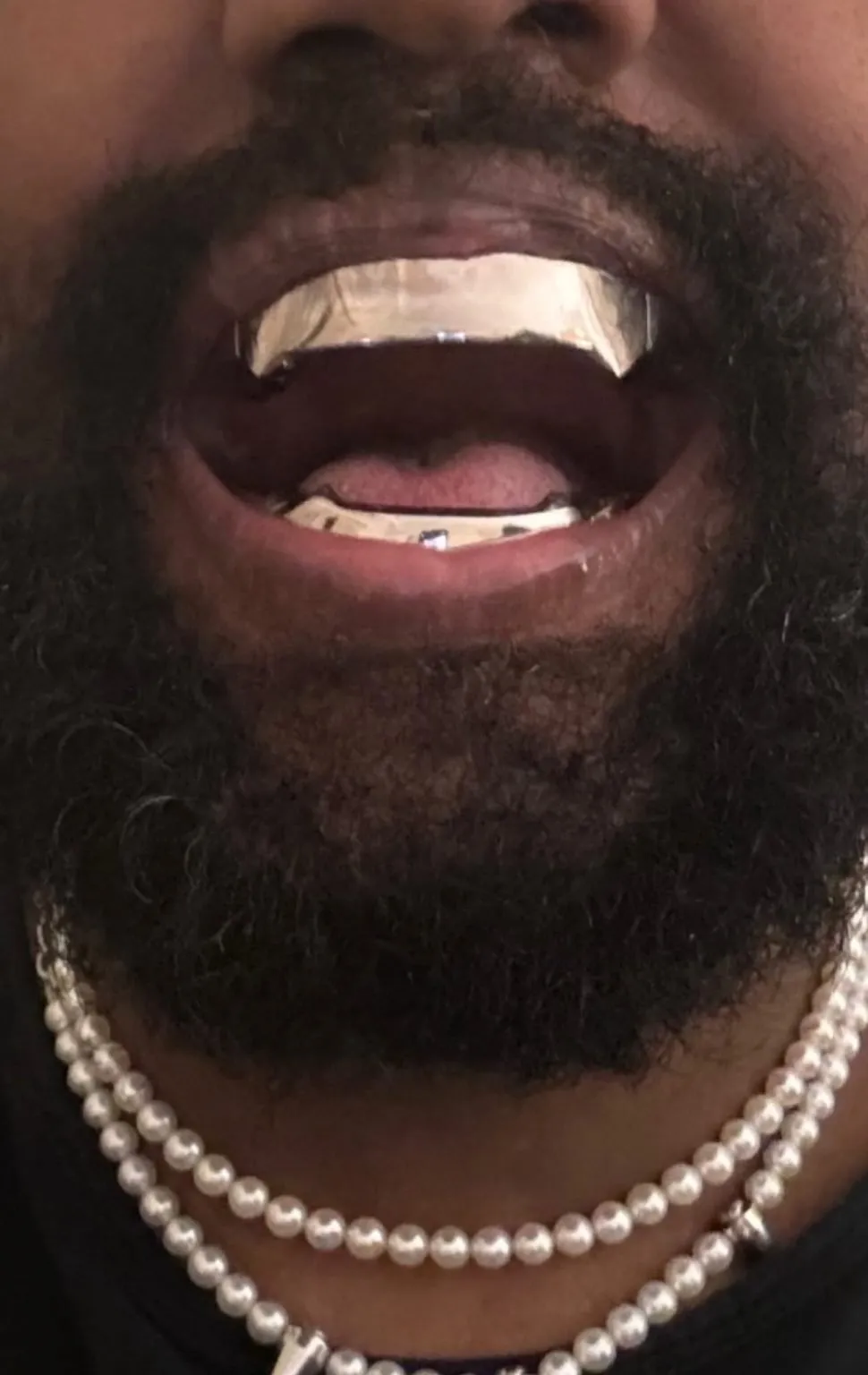 Ye's new titanium dentures. Image courtesy of Ye/Instagram.
