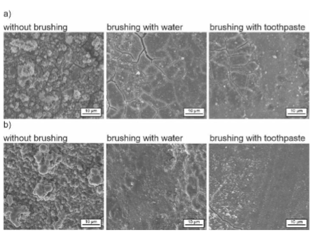 After drinking pure black tea (a) during CHX treatment, significantly stronger staining can be seen under the scanning electron microscope in comparison to drinking the beverage diluted with milk (b). Images and caption courtesy of Fraunhofer IMWS/Haleon.