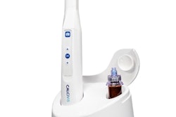 The Calcivis imaging device. Image courtesy of Calcivis.