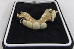 Partial upper gold-mounted denture designed for Sir Winston Churchill. Image courtesy of the Cotswold Auction Company.