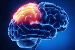 Brain
