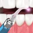 Dental Laser