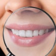 Teeth Magnifying Glass