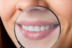 Teeth Magnifying Glass