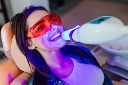 Teeth Whitening Woman