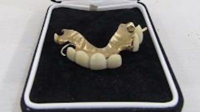Partial upper gold-mounted denture designed for Sir Winston Churchill. Image courtesy of the Cotswold Auction Company.