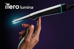 The iTero Lumina intraoral scanner wand. Image and caption courtesy of Align Technology Inc.