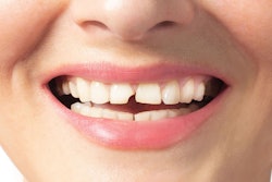 Broken Tooth Woman