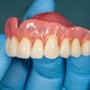 Denture Upper