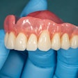 Denture Upper