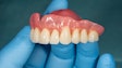 Denture Upper