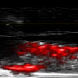 Researchers were able to visualize biofilms in teeth treated with dextran-coated gold nanoparticles using photoacoustic imaging.