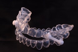 Oral Sleep Appliance