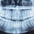 Panoramic Xray