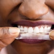 Teeth Whitening Strips Ed