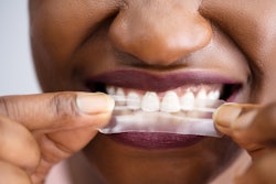 Teeth Whitening Strips Ed