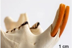 2024 04 22 Rodent Terracotta Teeth 400
