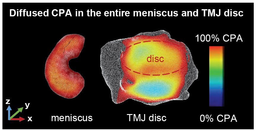 A study that came out of Clemson University's partnership with the Medical University of South Carolina and an industry collaborator sharpens the focus on the knee or the jaw's temporomandibular joint (TMJ). Image and caption courtesy of Clemson University.