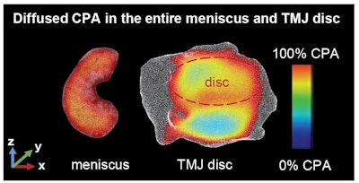 A study that came out of Clemson University's partnership with the Medical University of South Carolina and an industry collaborator sharpens the focus on the knee or the jaw's temporomandibular joint (TMJ). Image and caption courtesy of Clemson University.