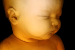 Fetus