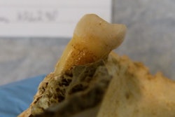 An EXAMPLE of a tooth prior to ancient DNA sampling. Note this was not the tooth sampled in the study.
