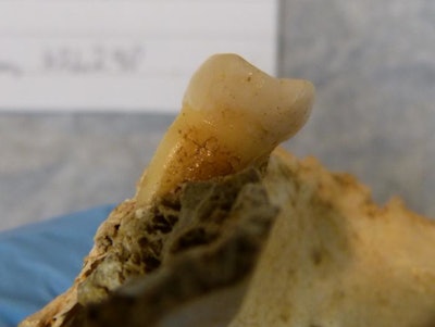 An EXAMPLE of a tooth prior to ancient DNA sampling. Note this was not the tooth sampled in the study.