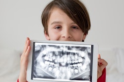 Boy Panoramic Xray