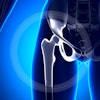 Hip Joint Female