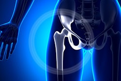 Hip Joint Female